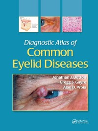 Image of DIAGNOSTIC ATLAS OF COMMON EYELID DISEASES